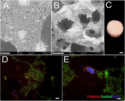 Use of Human Dental Pulp and Endothelial Cell Seeded Tyrosine-Derived Polycarbonate Scaffolds for Robust in vivo Alveolar Jaw Bone Regeneration